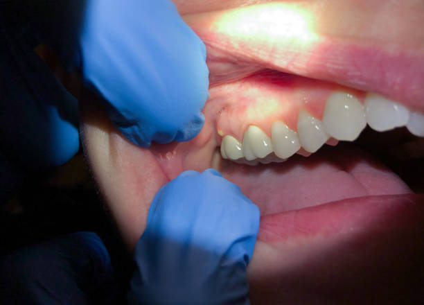 Best Emergency Dental Care for Trauma or Injury in Clinton, MO