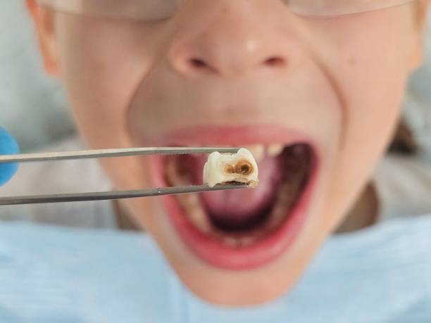 Best Pediatric Emergency Dentist in Clinton, MO