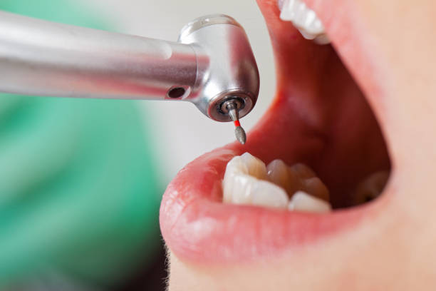 Best Emergency Treatment for Toothache in Clinton, MO